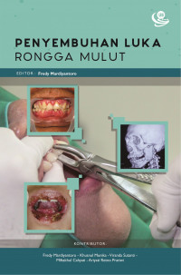 Penyembuhan Luka Rongga Mulut