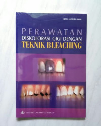 Perawatan Diskolorasi Gigi dengan Teknik Bleaching