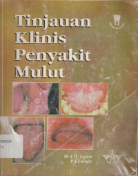 Tinjauan Klinis Penyakit Mulut