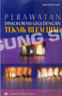 Image of Perawatan Diskolorasi Gigi dengan Teknik Bleaching