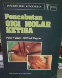 Image of Pencabutan Gigi Molar Ketiga