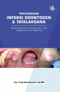 Image of Penyebaran Infeksi Odontogen dan Tatalaksana : Dasar Pemahaman tentang Infeksi pada Rongga Mulut dan Sekitarnya