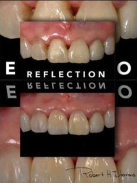 Image of Reflection