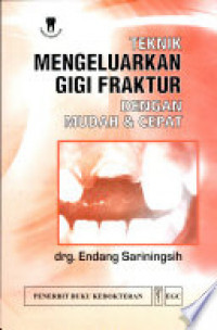 Teknik Mengeluarkan Gigi Faktur dengan Mudah & Cepat