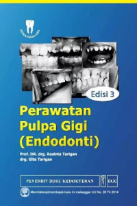 Image of Perawatan Pulpa Gigi (Endodonti)
