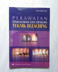 Perawatan Diskolorasi Gigi dengan Teknik Bleaching