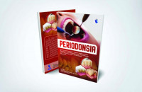 Periodonsia